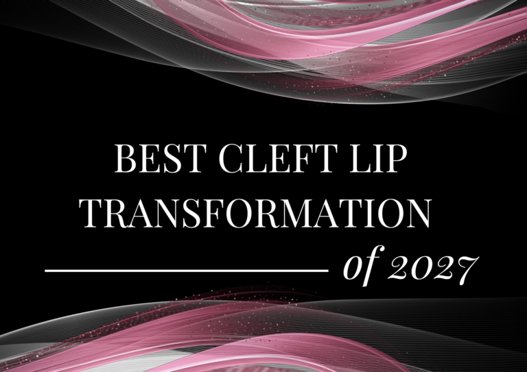 Best Cleft Lip Transformation